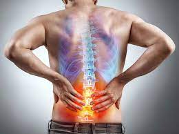 Back to Life: Managing and Preventing Low Back Pain