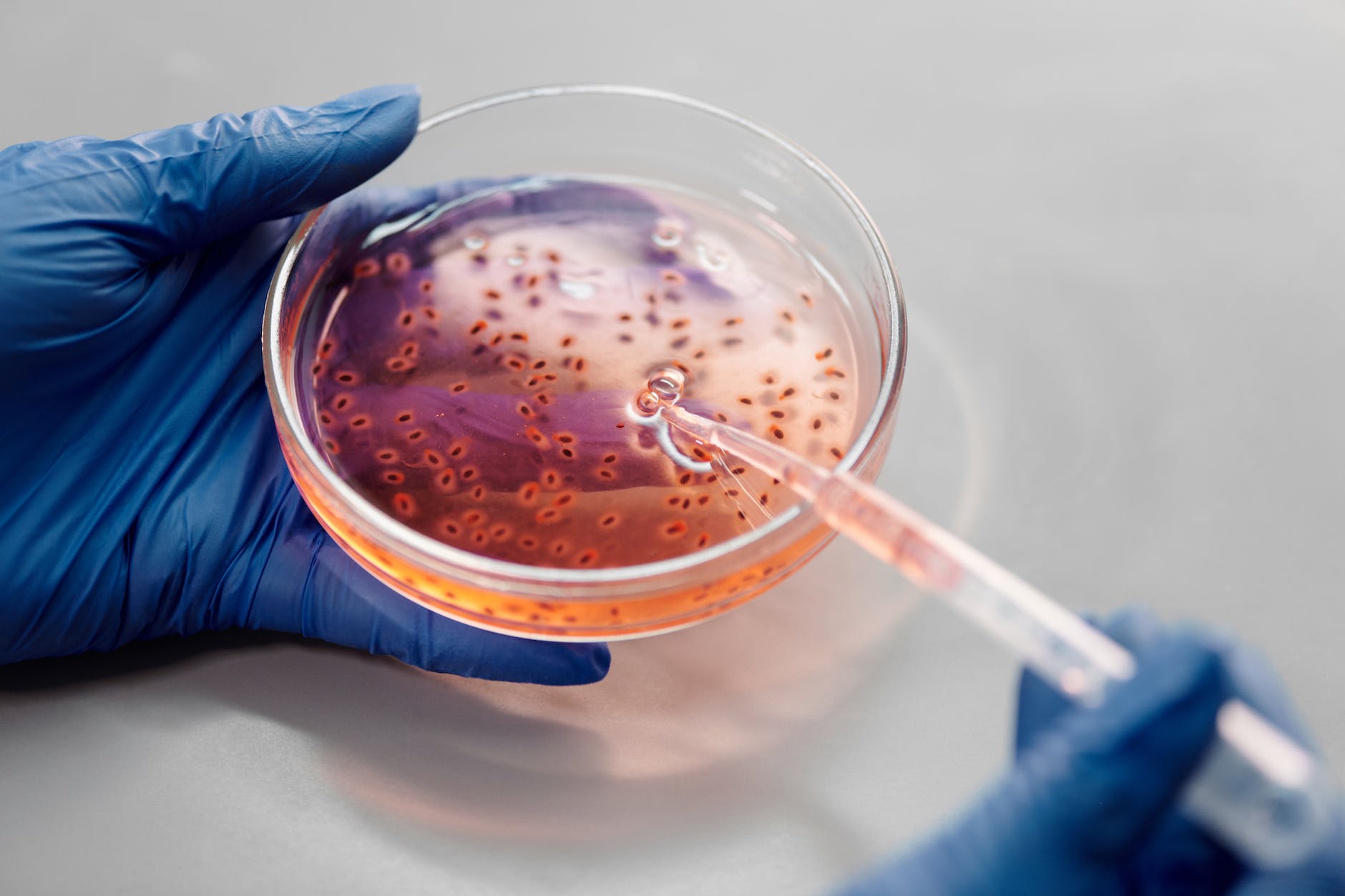 Outbreaks of Cyclospora and E. coli Continue to Grow