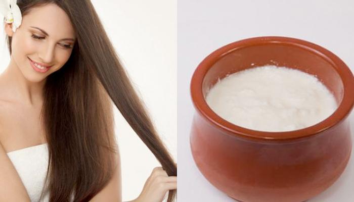 Naturally Beautiful Hair: Home Remedies for Dandruff Control