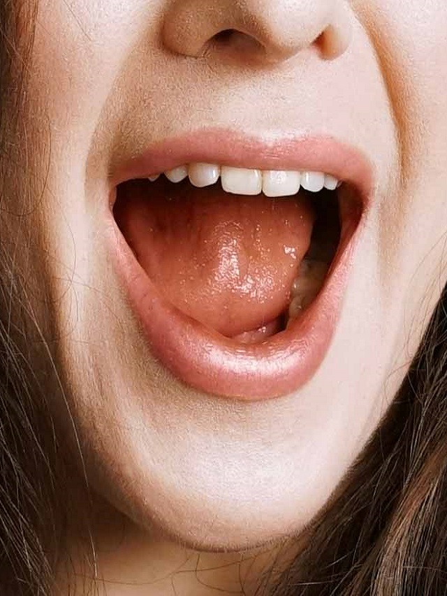 Signs and Symptoms of tongue cancer